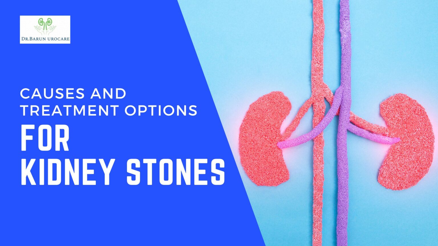 Causes and Treatment Options for Kidney Stones | Dr. Barun Kumar