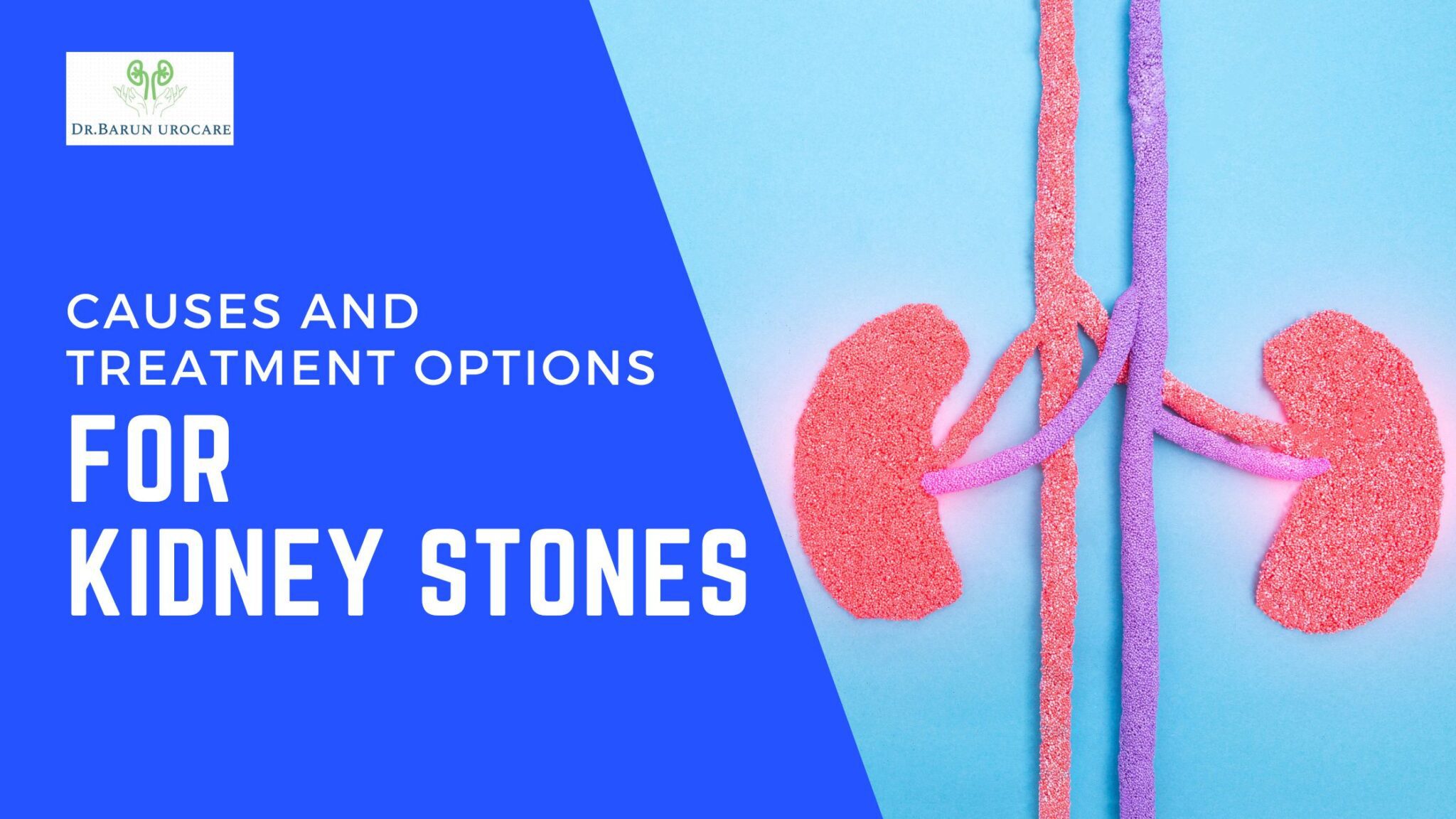 causes-and-treatment-options-for-kidney-stones-dr-barun-kumar